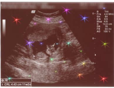 Sonogram from Oct of 08